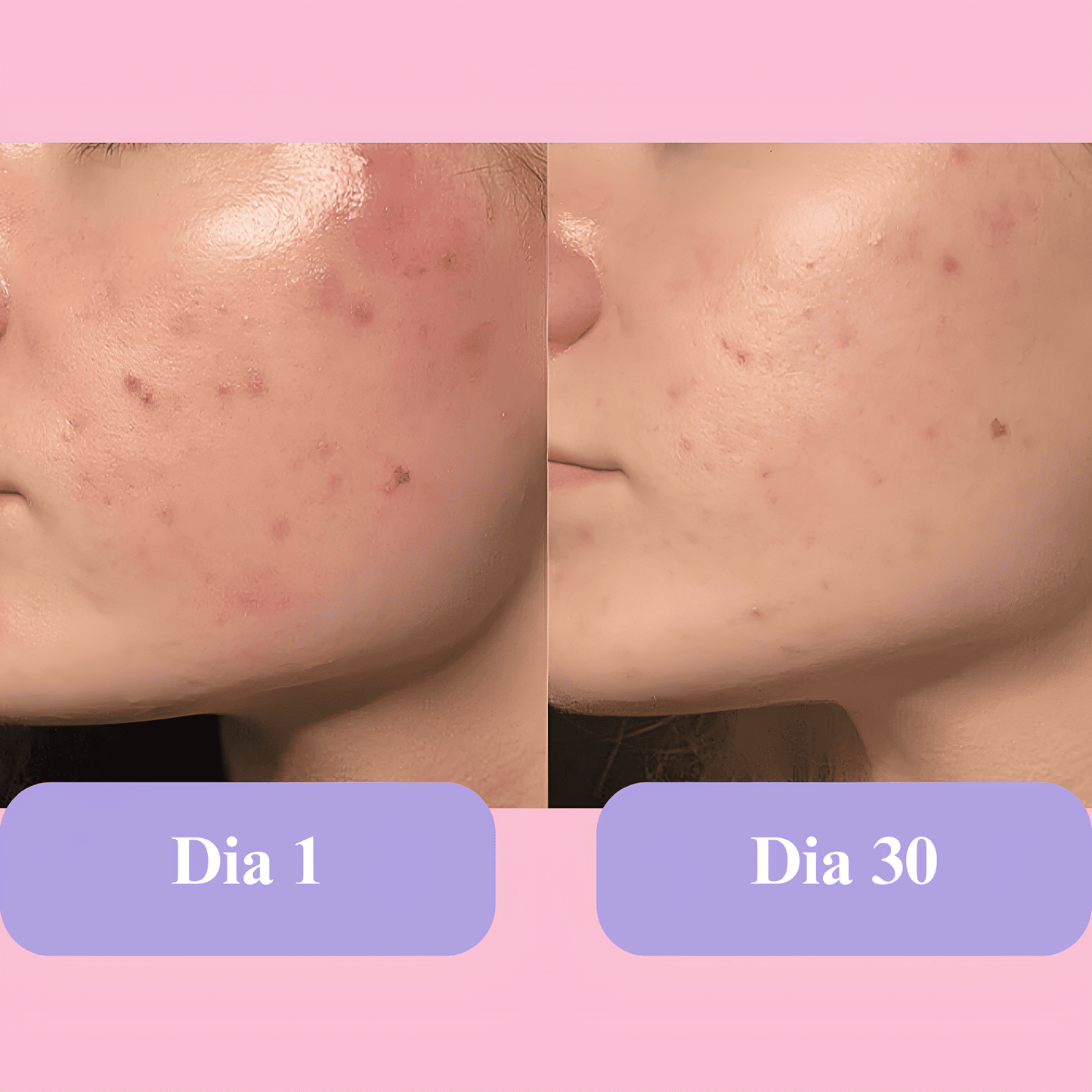 Máscara Lume Rejuvenescedora
