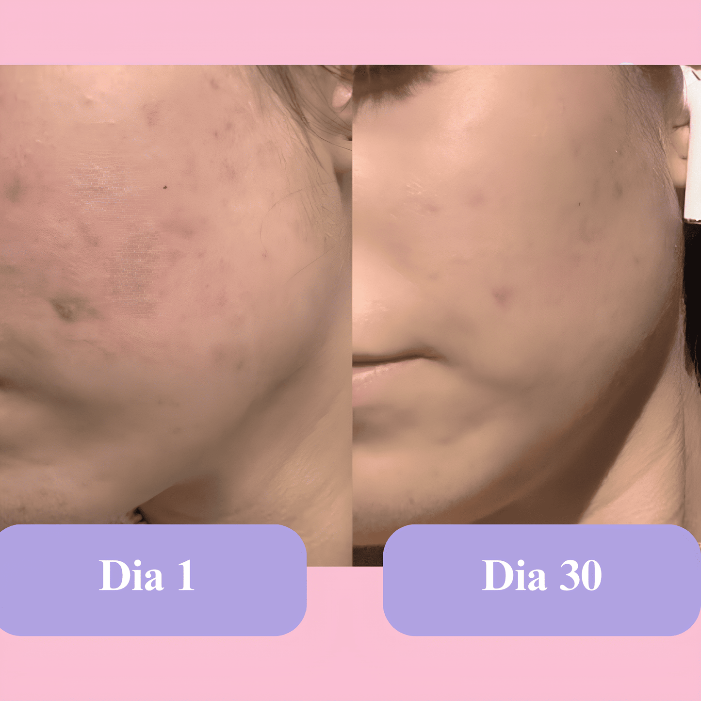 Máscara Lume Rejuvenescedora