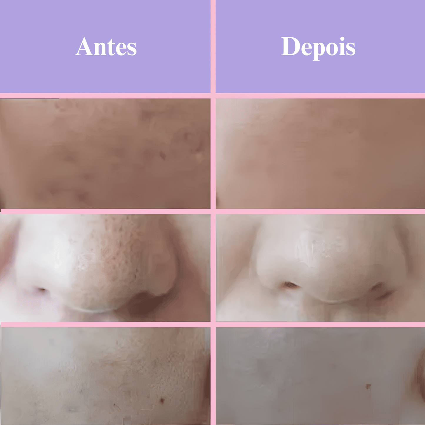 Máscara Lume Rejuvenescedora