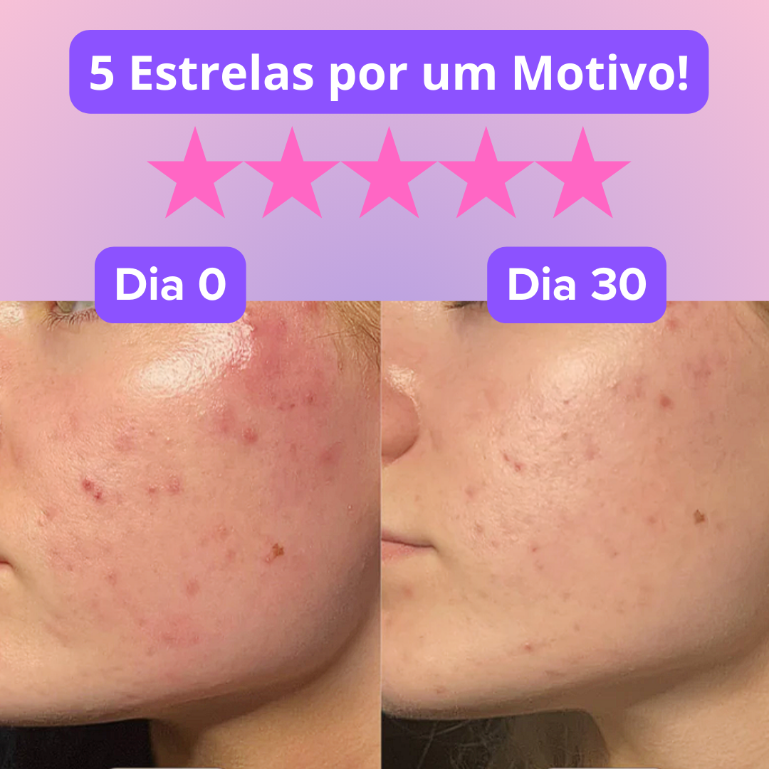 Máscara Lume Rejuvenescedora