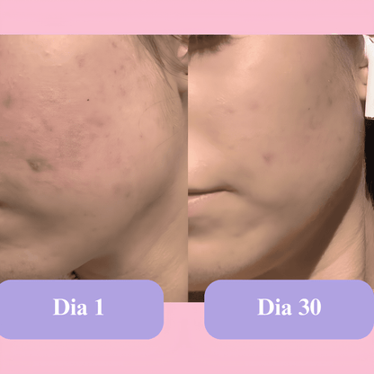 Máscara Lume Rejuvenescedora