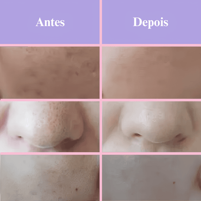 Máscara Lume Rejuvenescedora
